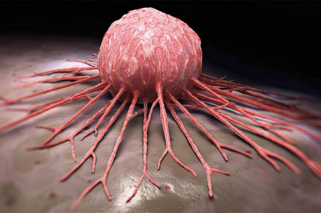 百年抗癌战役：放射免疫医疗新时代（4）