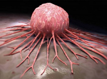 百年抗癌战役：放射免疫医疗新时代（4）