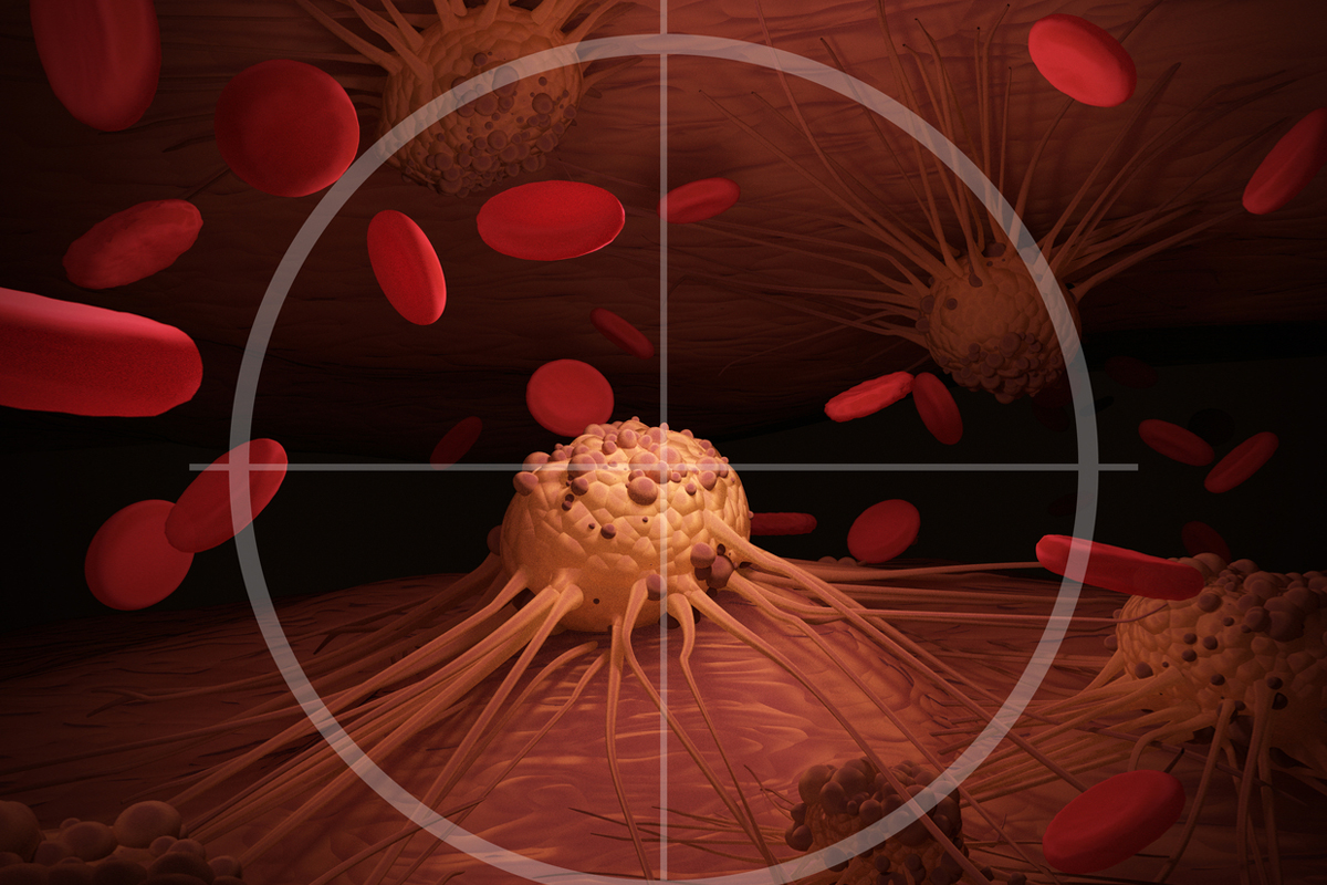 百年抗癌战役：放射免疫医疗新时代（5）