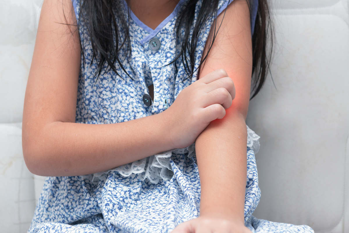 【健康专题】不致命却折腾 勿轻视儿童湿疹