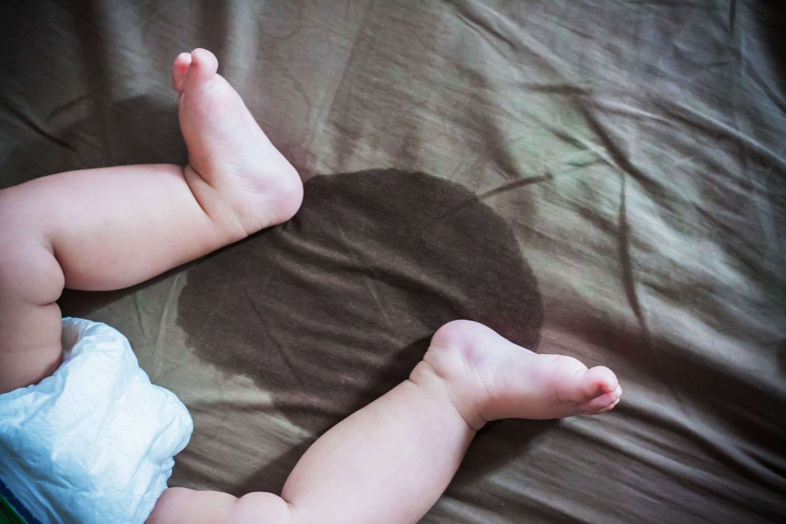 【医生专稿】给新手父母的话：何时需要儿科泌尿外科？